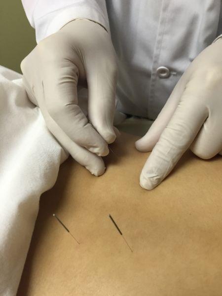 BECOME AN ACUPUNCTURIST AT CCATCM