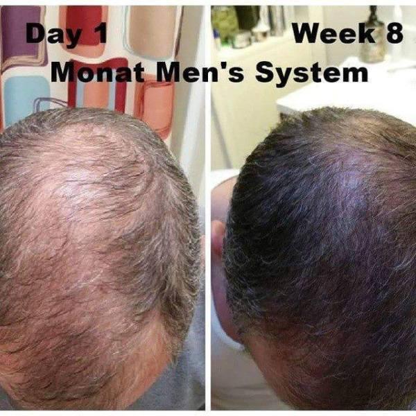 Monat Hair Treatment Systems