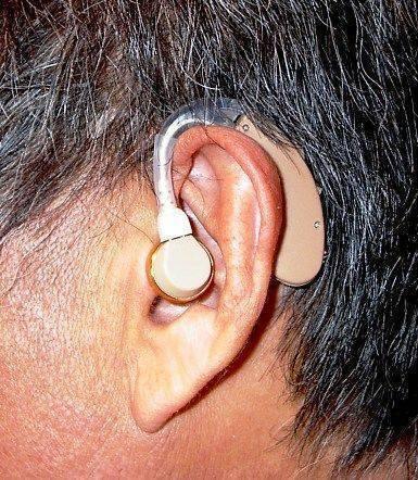 New Electronic hearing aid with Frequency Discriminating Chip